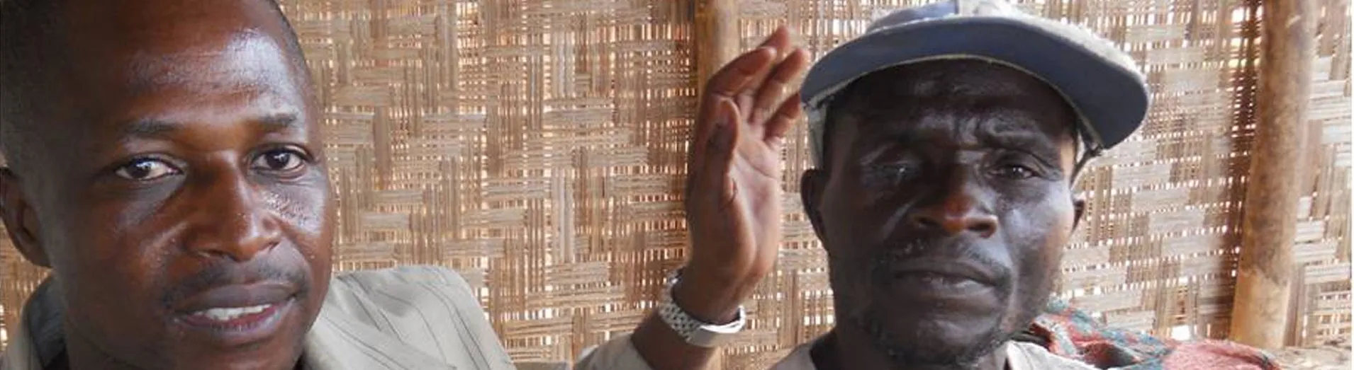 A man affected by river blindness